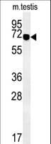ZBTB5 Antibody (aa178-206)