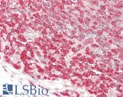 IHC-plus™ PTPN6 / SHP1 Antibody