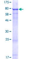 Human ZNF548 Protein (Recombinant GST)
