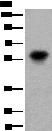 CDT1 Antibody