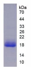 Human IL18 Protein (Recombinant His)