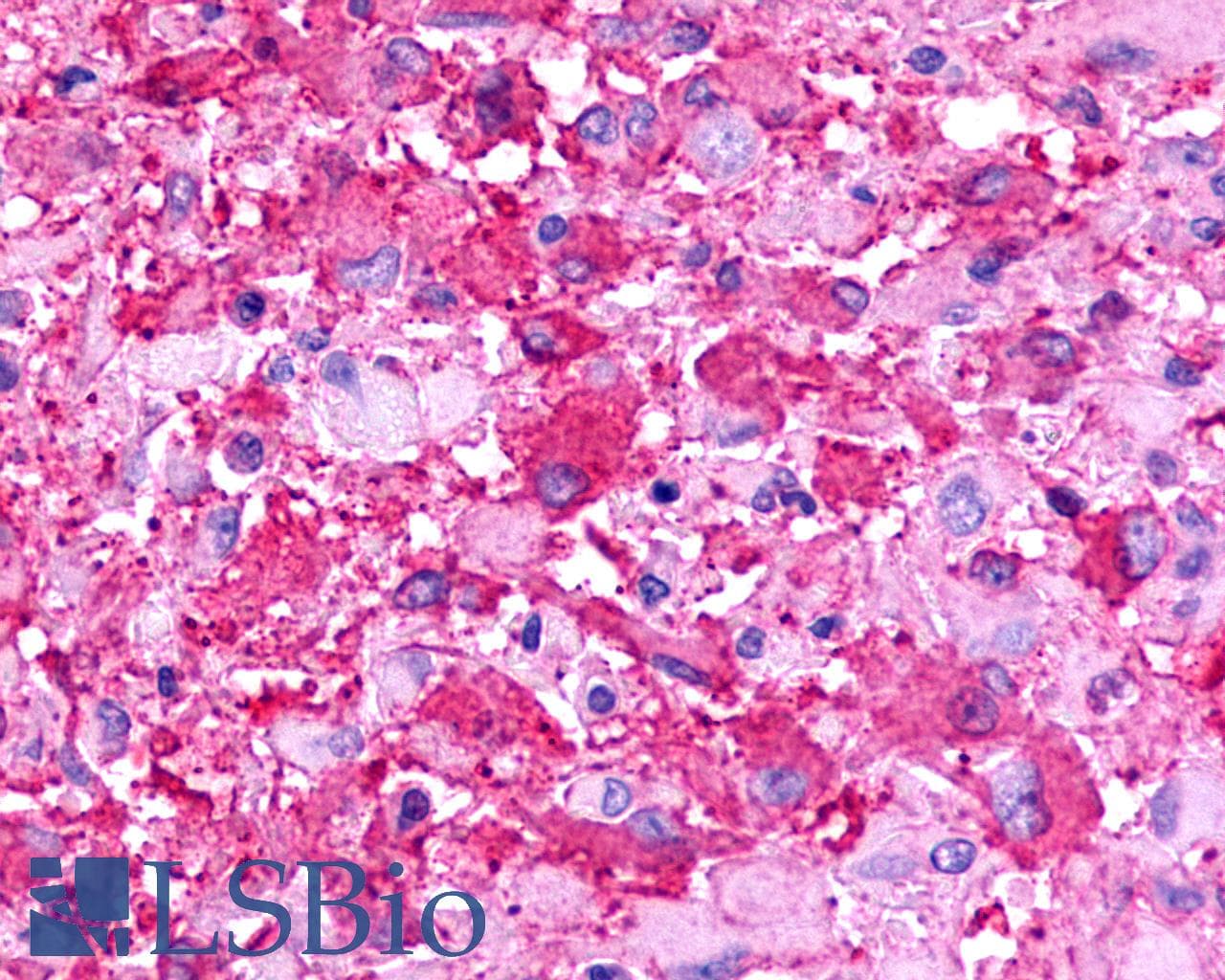 PathPlus™ TPRA1 / GPR175 Antibody (Cytoplasmic Domain)