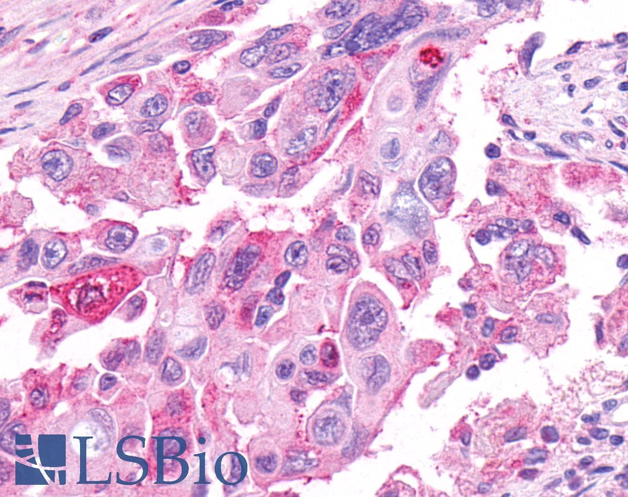 PathPlus™ GPR48 / LGR4 Antibody (N-Terminus)