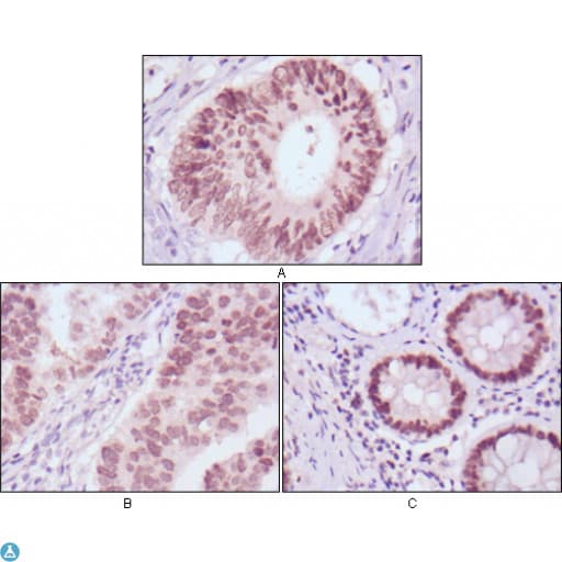 Monoclonal Mouse anti-Human FOXA2 Antibody (IHC, WB)