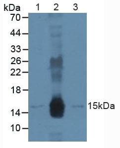 DDB2 Antibody (aa166-383, APC)
