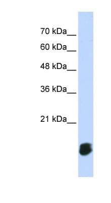 GLRX5 / Glutaredoxin 5 Antibody (aa71-120)