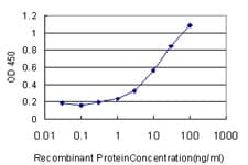 CA12 / Carbonic Anhydrase XII Antibody (clone 1D4)