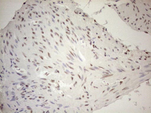 Monoclonal Mouse anti-Human RGL2 Antibody (clone OTI10F2, aa547-777, IHC, WB)