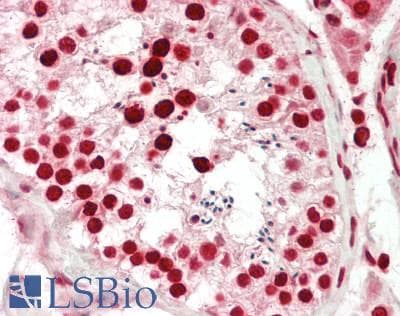 IHC-plus™ Polyclonal Rabbit anti-Human DNAJB8 Antibody (aa41-69, IHC, WB)