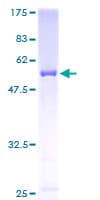 Human CLIC2 Protein (Recombinant GST)