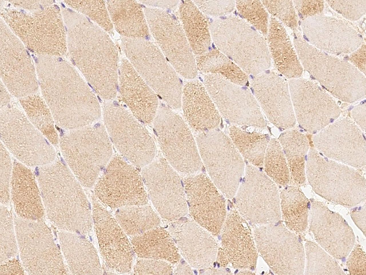CACNA2D1 Antibody
