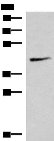 SMPD2 Antibody