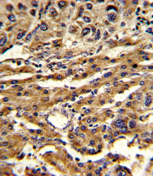 ABCG1 Antibody (aa359-387)