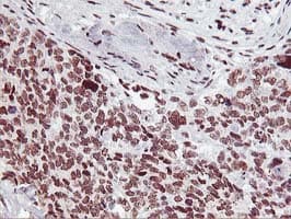 HOXC11 Antibody (aa1-304, clone OTI3E10, Carrier-free)