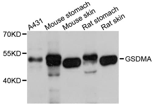 Polyclonal Rabbit anti-Mouse GSDMA Antibody (WB)