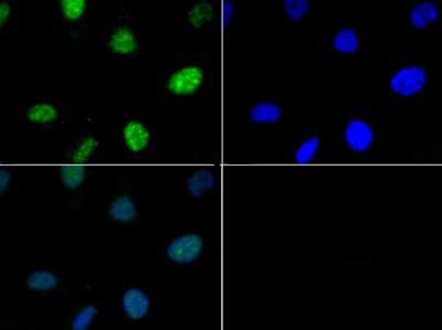 HIST3H3 Antibody (phospho-Thr6)
