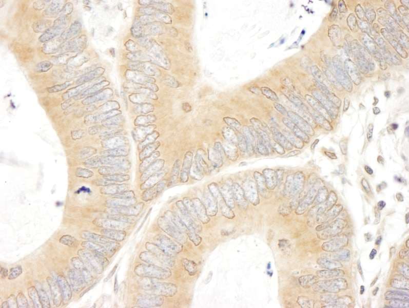ABCF1 Antibody (aa150-200)