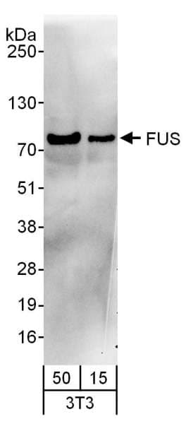 Polyclonal Goat anti-Human FUS / TLS Antibody (aa1-50, IHC, WB)