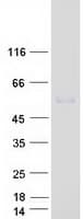 Human CYP4Z1 Protein (Recombinant Myc-DDK (Flag))