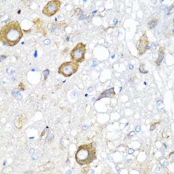 IHC-plus™ MGP / Matrix Gla-Protein Antibody