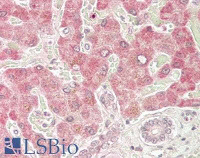 IHC-plus™ IRS2 / IRS-2 Antibody