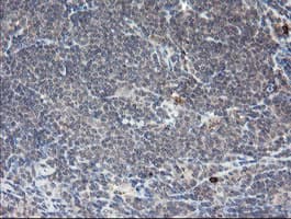 APP / Beta Amyloid Precursor Antibody (clone OTI4C9)