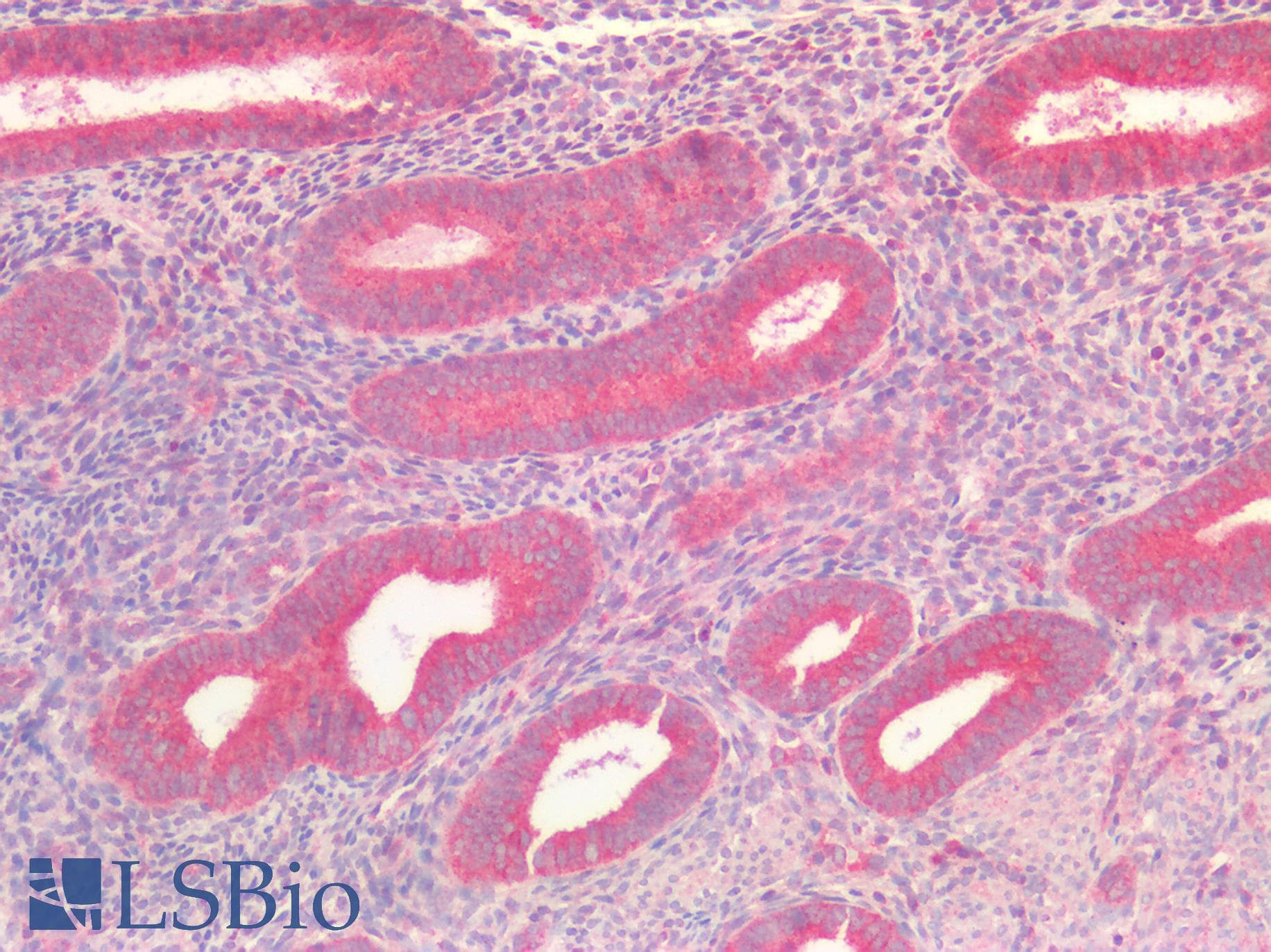 IHC-plus™ TP53 / p53 Antibody