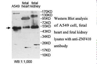 ZNF410 Antibody (aa49-244)
