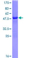 Human HPGDS Protein (Recombinant GST)