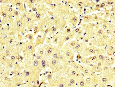 GPT / Alanine Transaminase Antibody (aa2-496)
