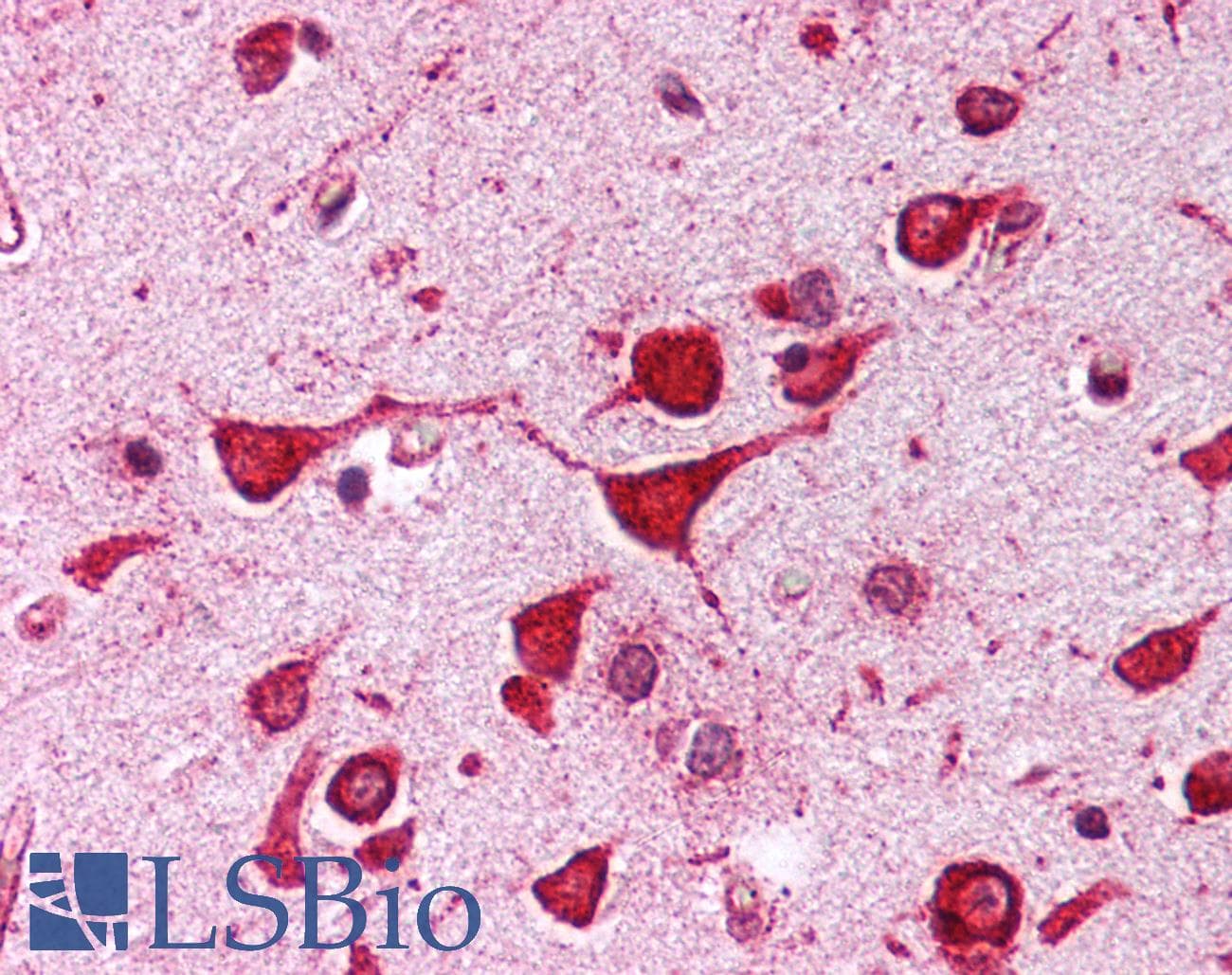 IHC-plus™ Polyclonal Rabbit anti-Human KCNIP3 / Dream / Calsenilin Antibody (aa26-35, IHC, WB)