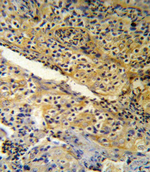 SPINK5 / LEKTI Antibody (aa188-217)