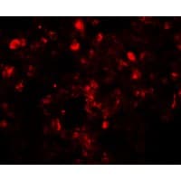 IHC-plus™ TSN / Translin Antibody