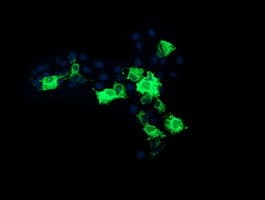 CMPK / CMPK1 Antibody (clone OTI1A1)