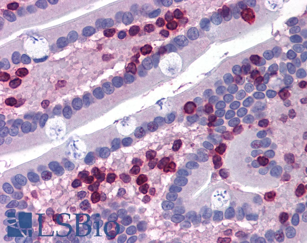 IHC-plus™ Polyclonal Goat anti-Human ALOX5AP / FLAP Antibody (aa28-40, IHC, WB)