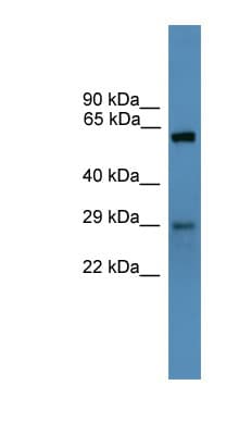 PRPK / TP53RK Antibody (N-Terminus)