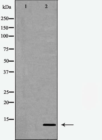 Polyclonal Rabbit anti-Human CKS1B / CKS1 Antibody (IF, WB)