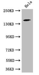 TNRC6C Antibody