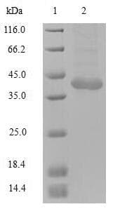 Human TRIM72 / MG53 Protein (Recombinant Myc-DDK (Flag), C-terminus)