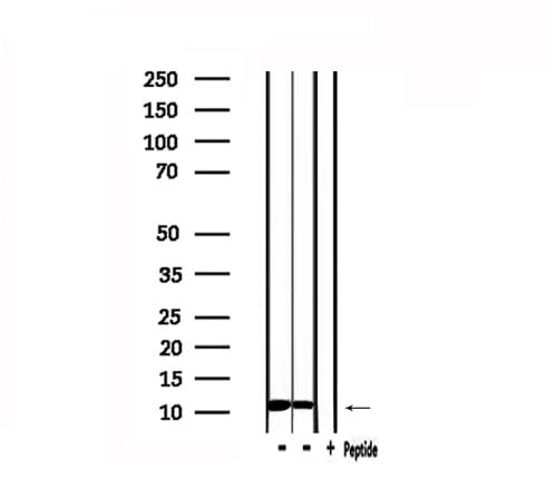 Polyclonal Rabbit anti-Human MIF Antibody (IHC, WB)