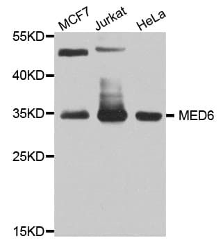 Polyclonal Rabbit anti-Human MED6 Antibody (WB)