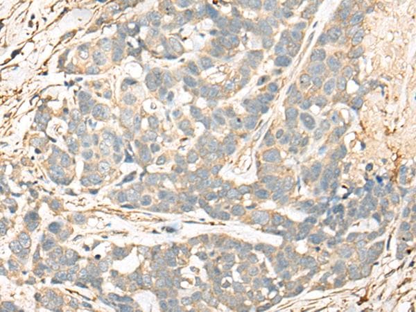 CD55 Antibody