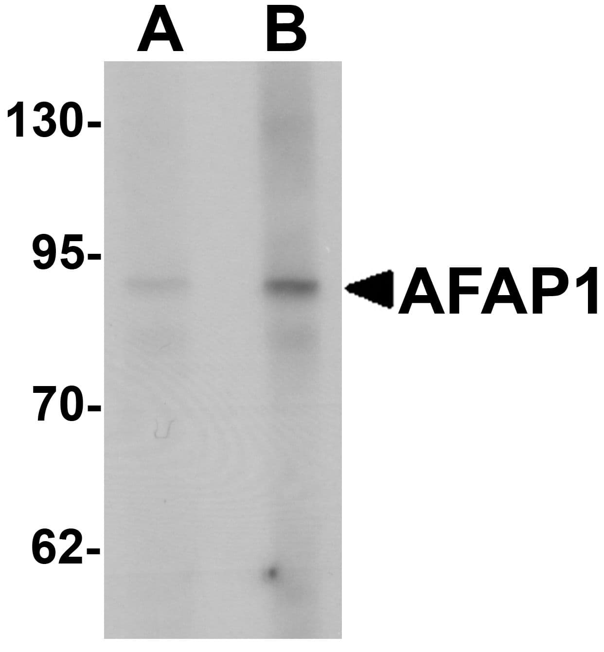 IHC-plus™ Polyclonal Rabbit anti-Human AFAP1 / AFAP Antibody (IHC, WB)