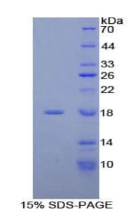 Human NDUFAB1 / ACP Protein (Recombinant His-T7)