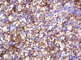 CA12 / Carbonic Anhydrase XII Antibody (clone OTI4G3)