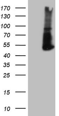 Monoclonal Mouse anti-Human PD-L2 / PDCD1LG2 / CD273 Antibody (clone OTI5E5, IHC, WB)