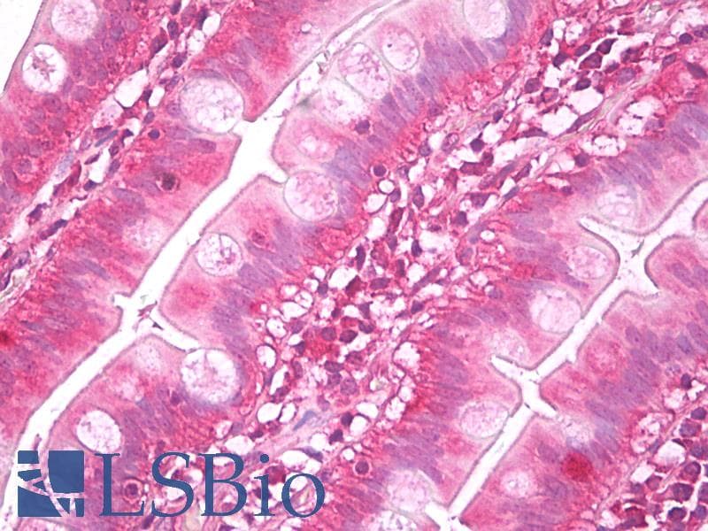 IHC-plus™ NUDT1 / MTH1 Antibody