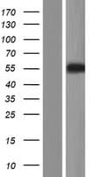 Human KRT38 / Keratin 38 / KRTHA8 Protein (Over-Expression Lysate Myc-DDK (Flag))