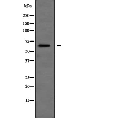 SH3BP2 Antibody