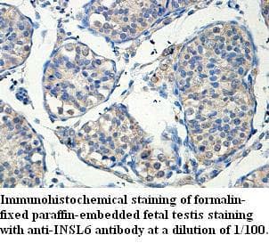 Polyclonal Rabbit anti-Human INSL6 Antibody (aa34-194, IHC, WB)